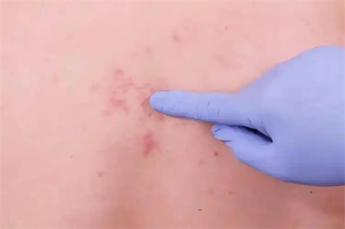 细节介绍