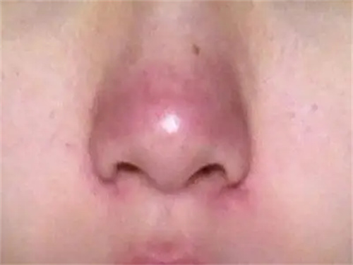 细节呈现